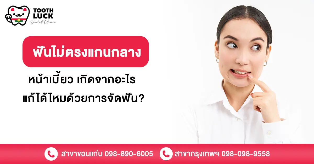 ฟันไม่ตรงแกนกลาง หน้าเบี้ยว เกิดจากอะไร แก้ได้ไหมด้วยการจัดฟัน?