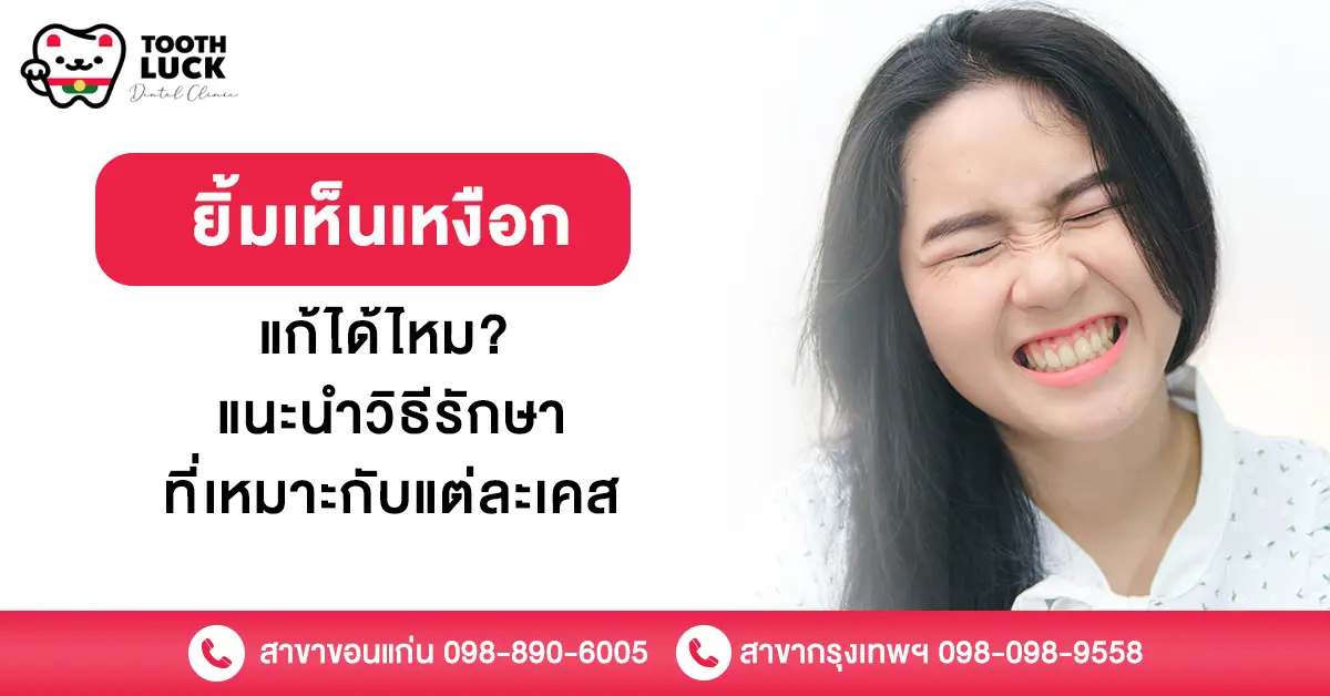 ยิ้มเห็นเหงือก แก้ได้ไหม? แนะนำวิธีรักษาที่เหมาะกับแต่ละเคส