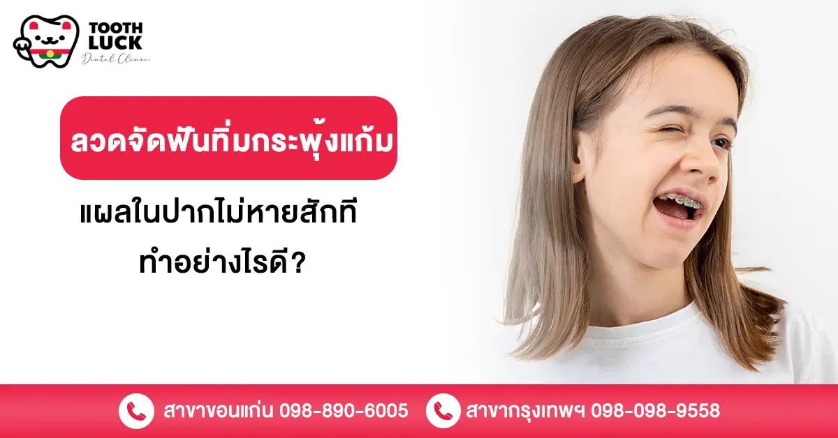 ลวดจัดฟันทิ่มกระพุ้งแก้ม แผลในปากไม่หายสักที ทำอย่างไรดี?