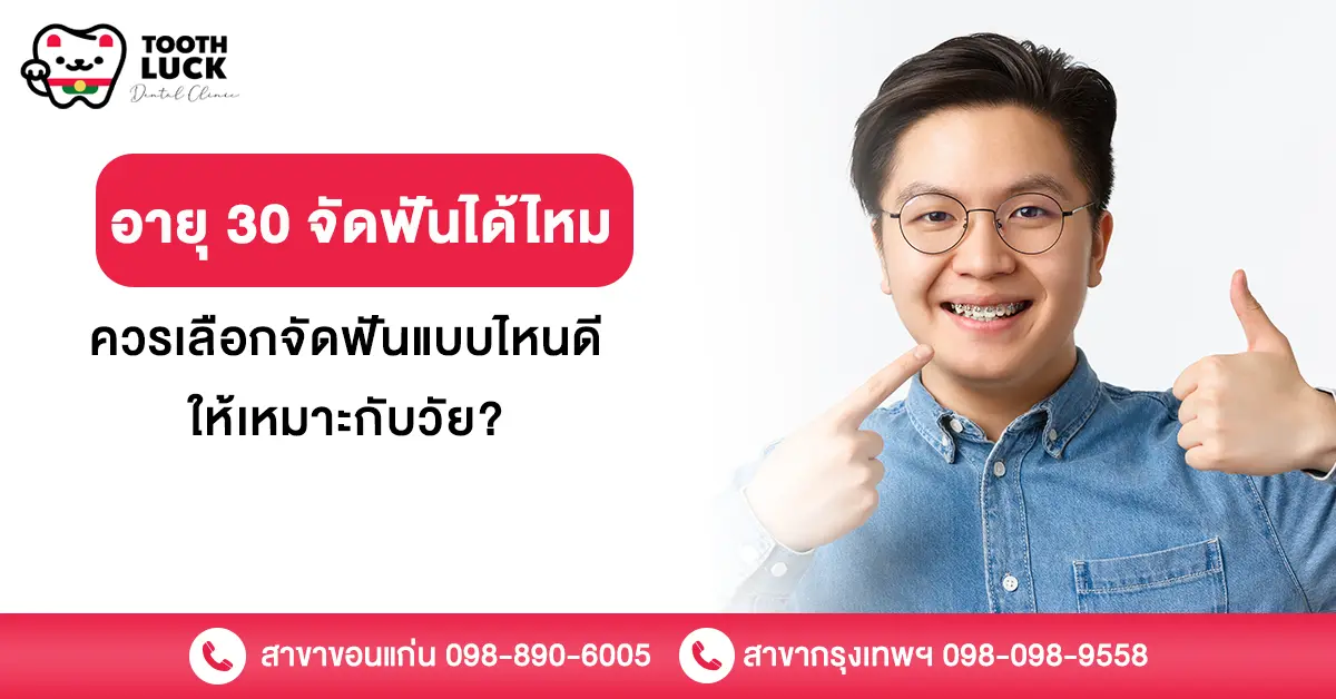 อายุ 30 จัดฟันได้ไหม ควรเลือกจัดฟันแบบไหนดีให้เหมาะกับวัย?
