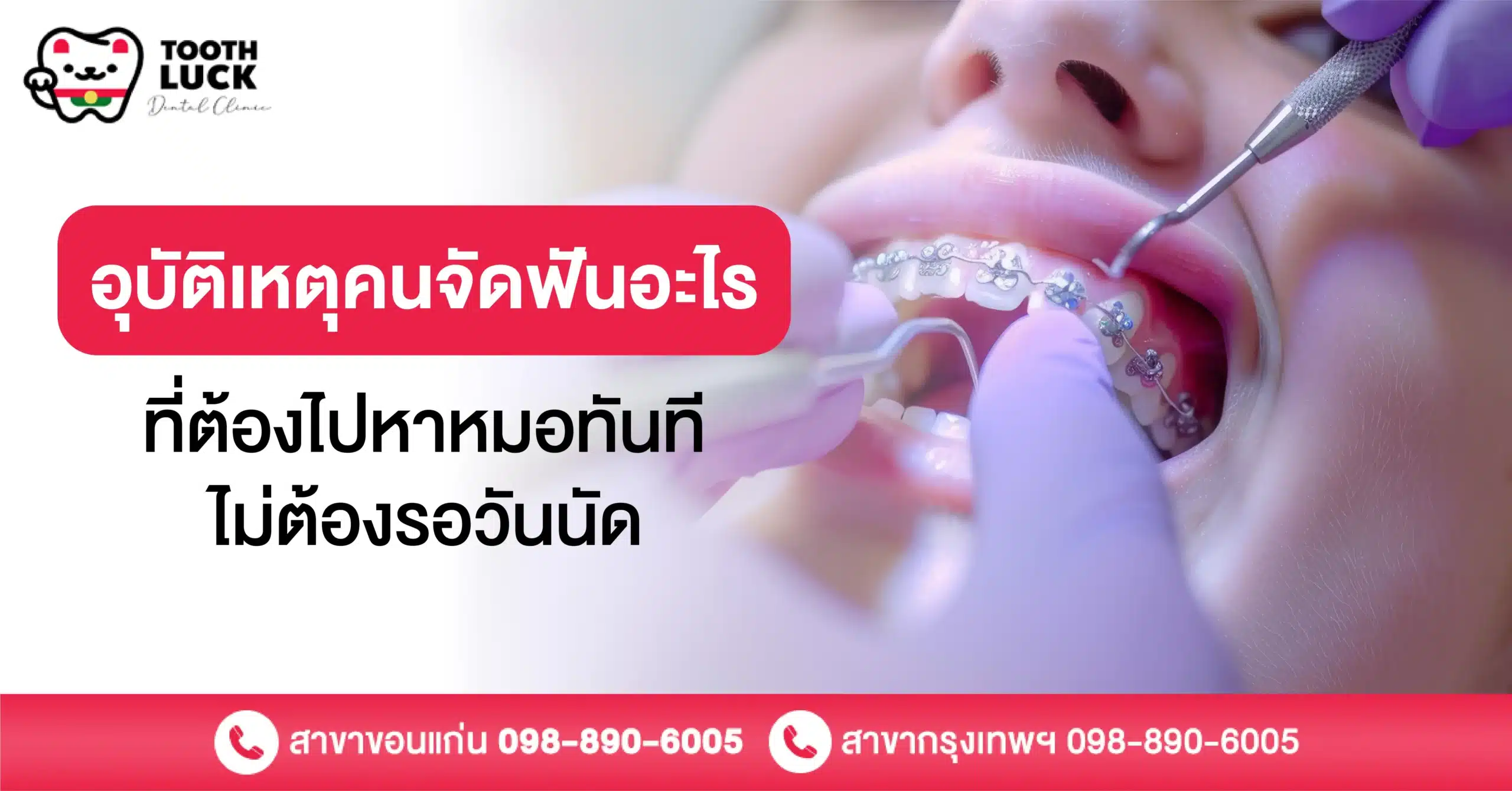 อุบัติเหตุคนจัดฟันอะไรที่ต้องไปหาหมอทันที ไม่ต้องรอวันนัด