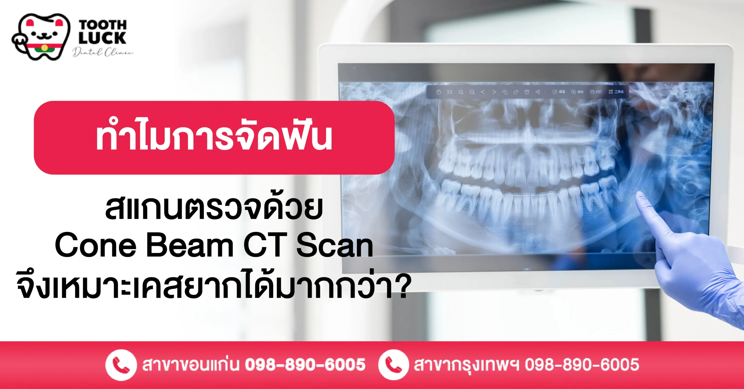 ทำไมการจัดฟันสแกนตรวจด้วย Cone Beam CT Scan จึงเหมาะเคสยากได้มากกว่า?