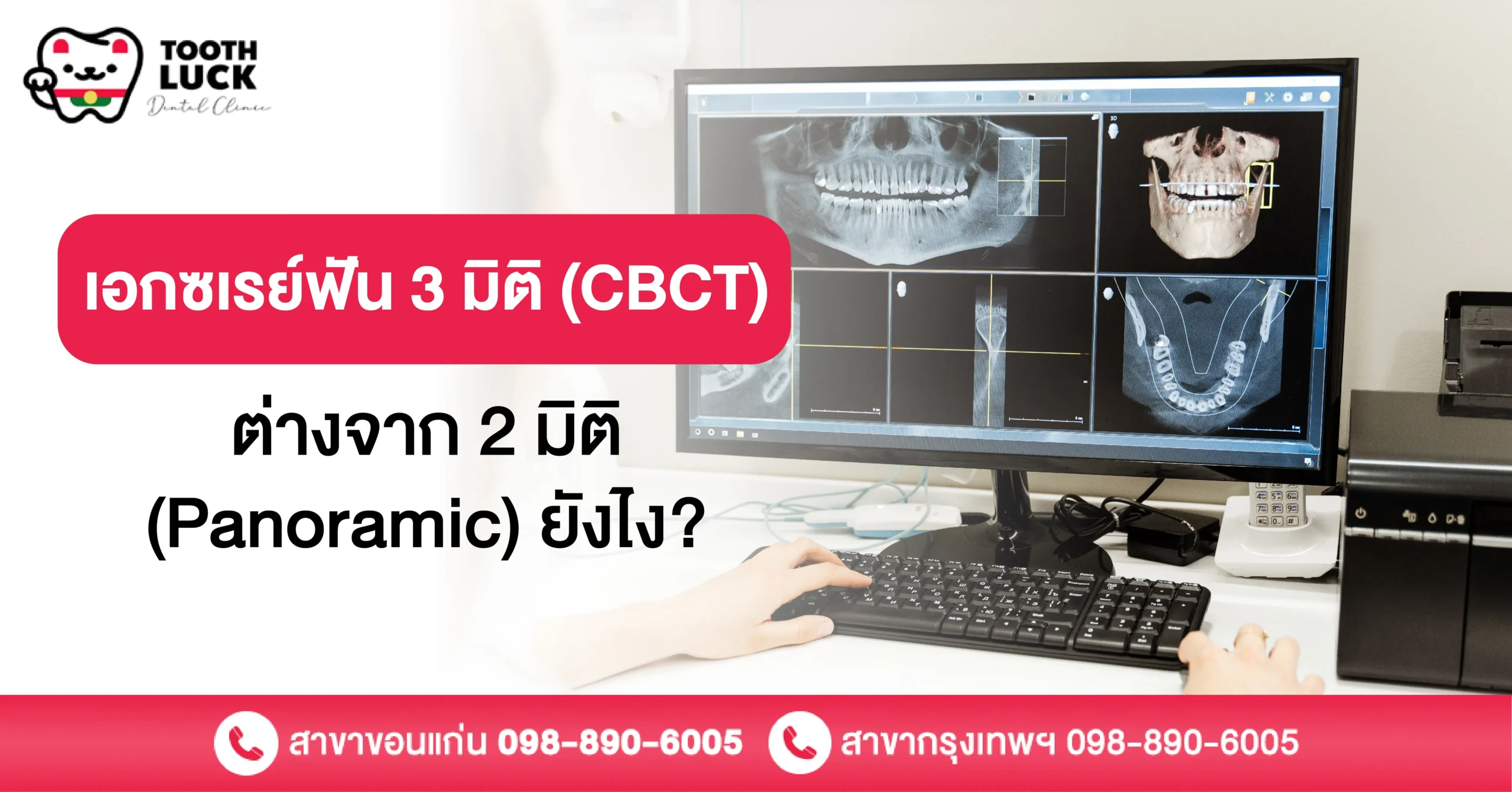 เอกซเรย์ฟัน 3 มิติ (CBCT) ต่างจาก 2 มิติ (Panoramic) ยังไง?