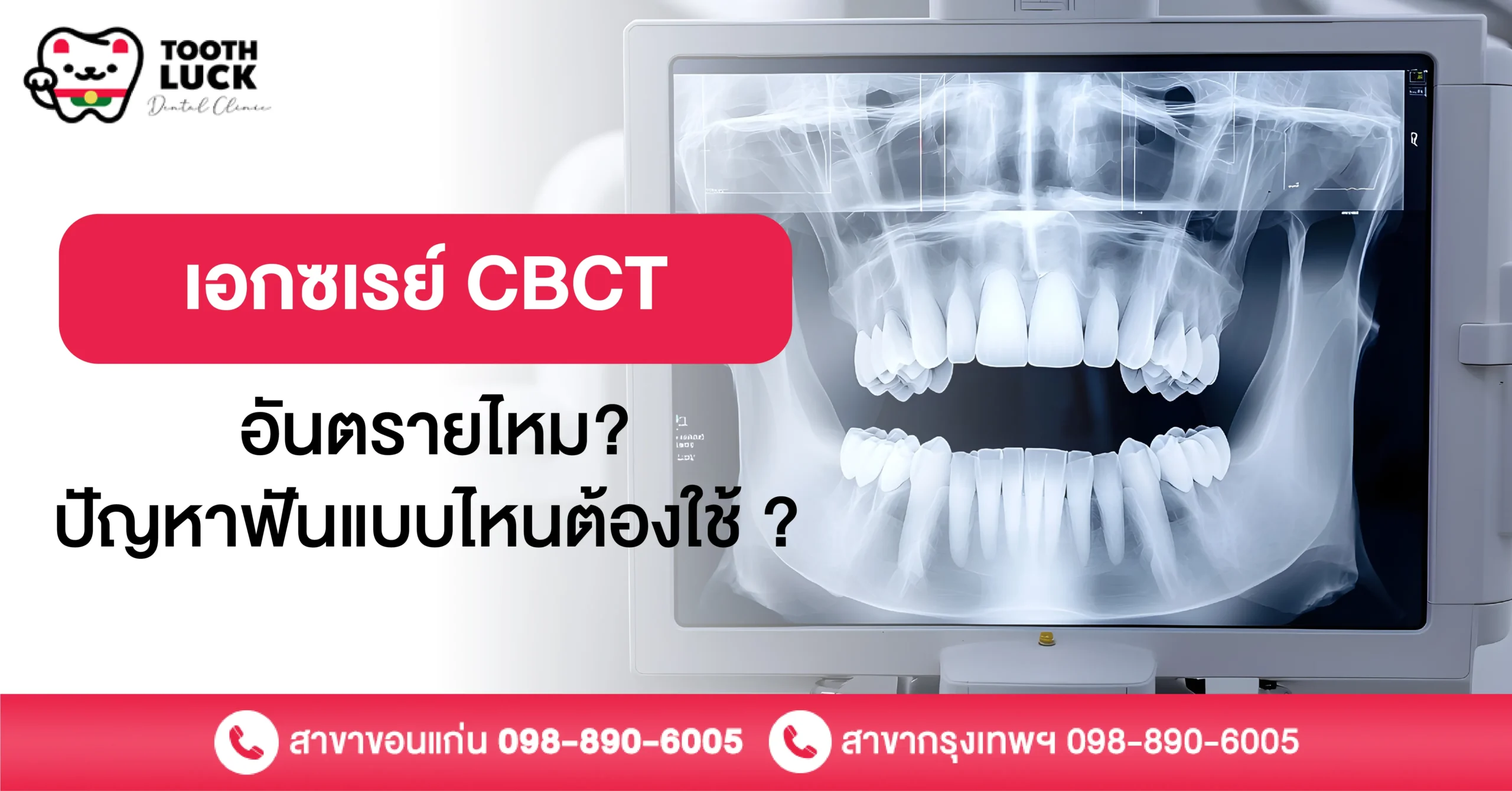 เอกซเรย์ CBCT อันตรายไหม? ปัญหาฟันแบบไหนต้องใช้