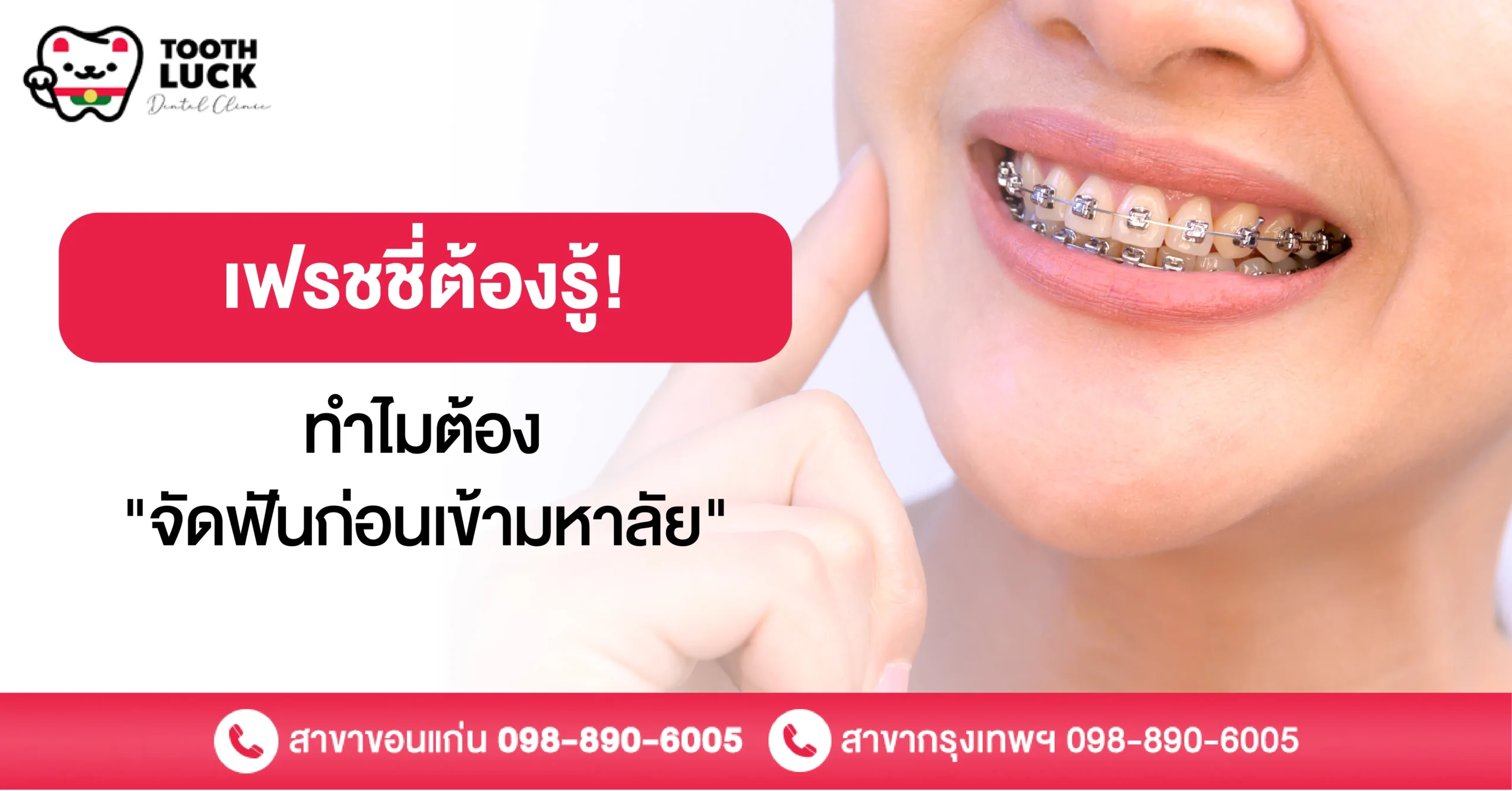 เฟรชชี่ต้องรู้! ทำไมต้อง "จัดฟันก่อนเข้ามหาลัย"