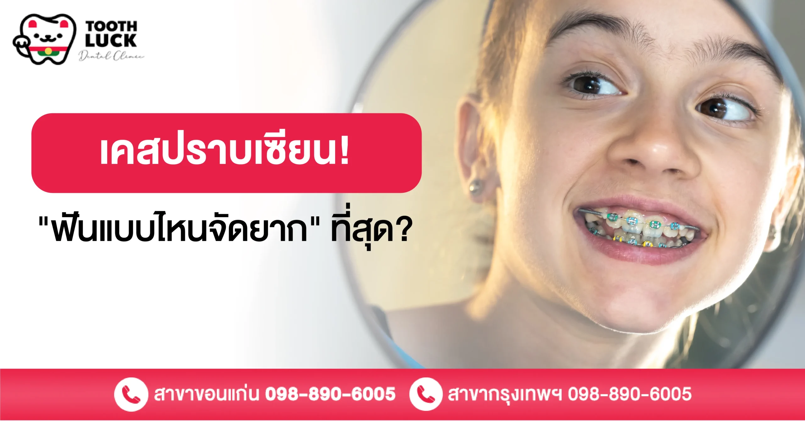 เคสปราบเซียน! "ฟันแบบไหนจัดยาก" ที่สุด?