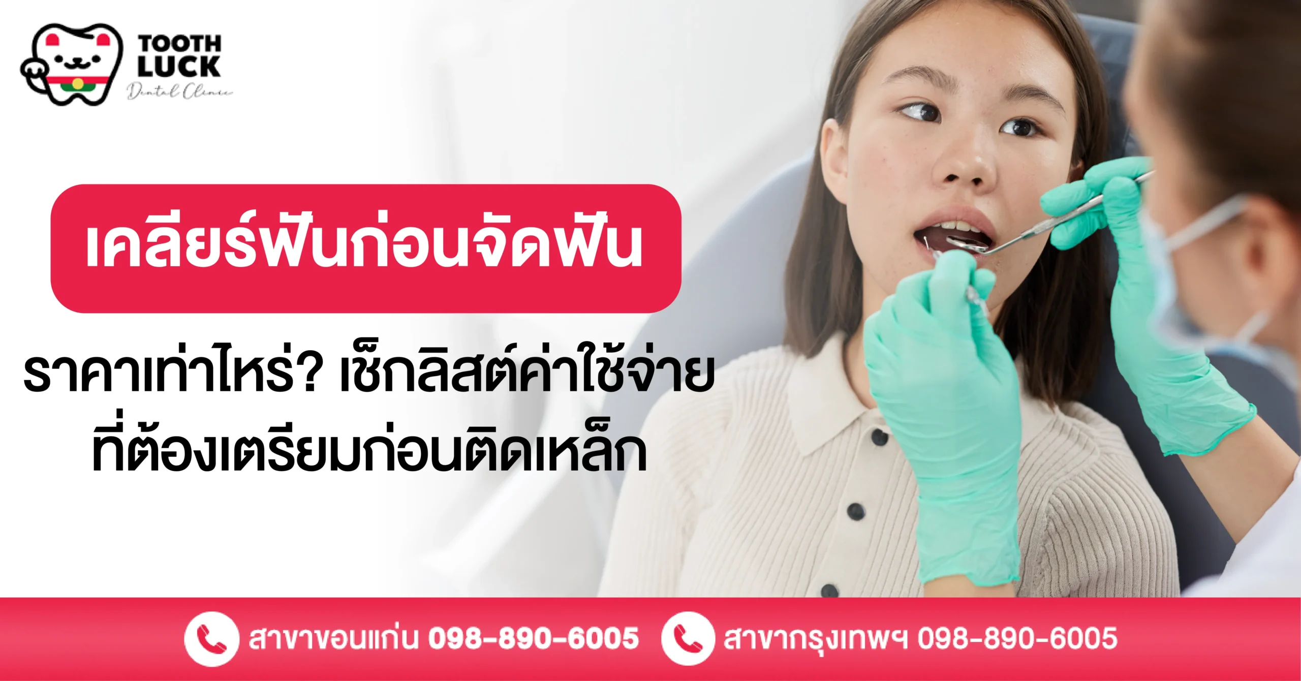 เคลียร์ฟันก่อนจัดฟัน ราคาเท่าไหร่? เช็กลิสต์ค่าใช้จ่ายก่อนติดเหล็ก