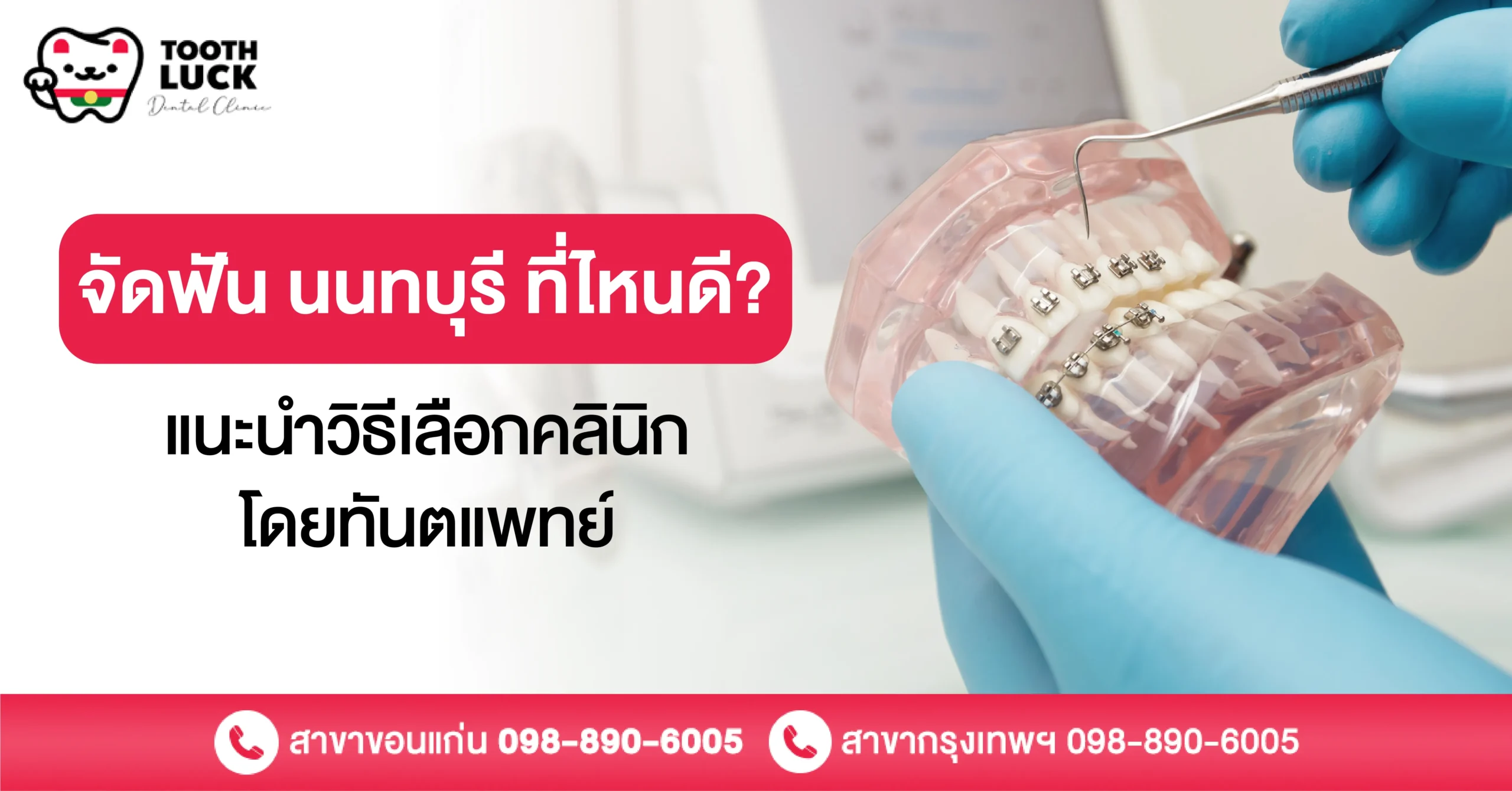 จัดฟัน นนทบุรี ที่ไหนดี? แนะนำวิธีเลือกคลินิกโดยทันตแพทย์