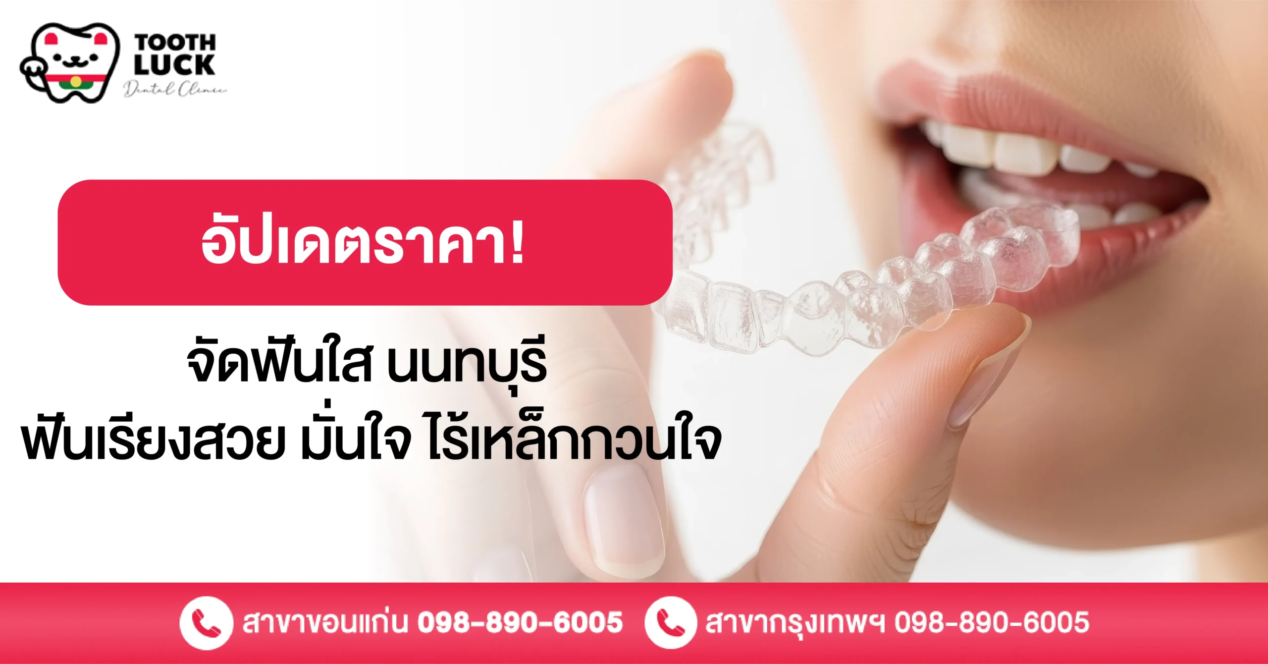 อัปเดตราคา จัดฟันใส นนทบุรี ฟันเรียงสวย มั่นใจ ไร้เหล็กกวนใจ