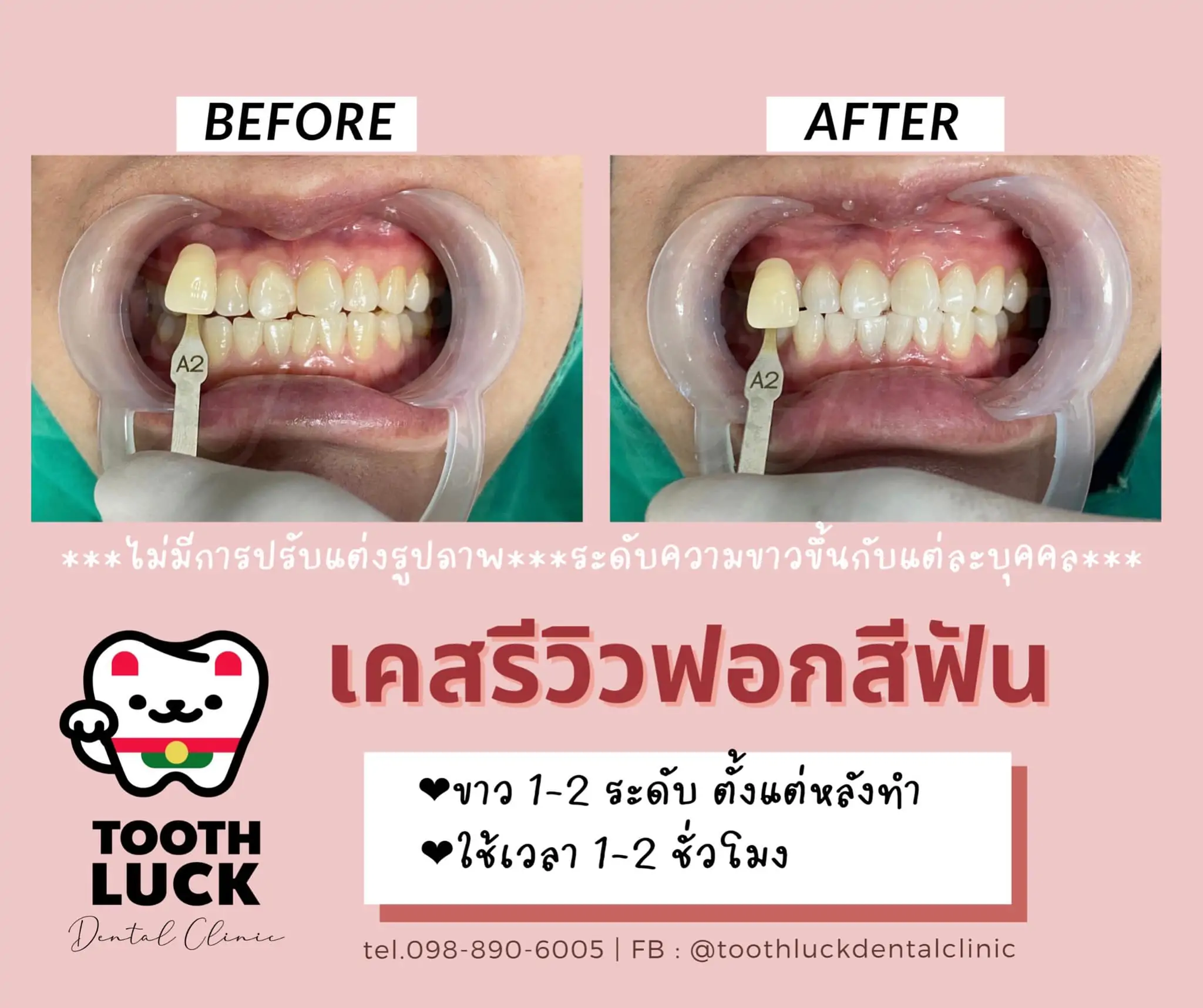 ฟอกสีฟัน