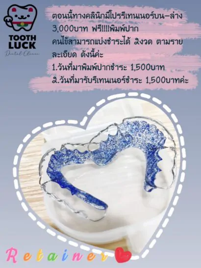 รีวิวบริการทำรีเทนเนอร์ กับ Tooth Luck dental clinic คลินิกทำฟัน จัดฟัน ขอนแก่น