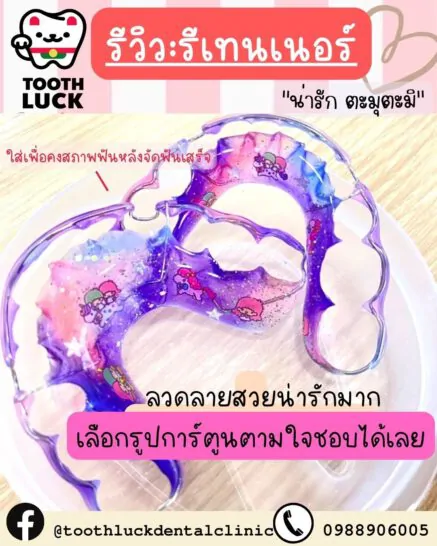 รีวิวบริการทำรีเทนเนอร์ กับ Tooth Luck dental clinic คลินิกทำฟัน จัดฟัน ขอนแก่น