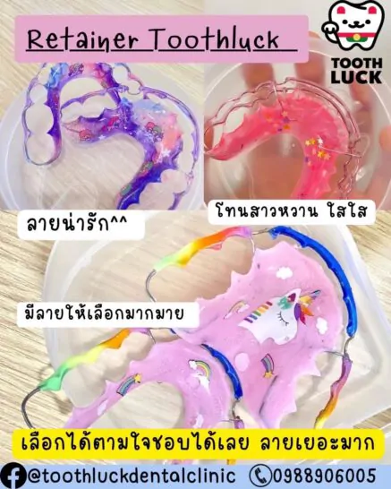 รีวิวบริการทำรีเทนเนอร์ กับ Tooth Luck dental clinic คลินิกทำฟัน จัดฟัน ขอนแก่น