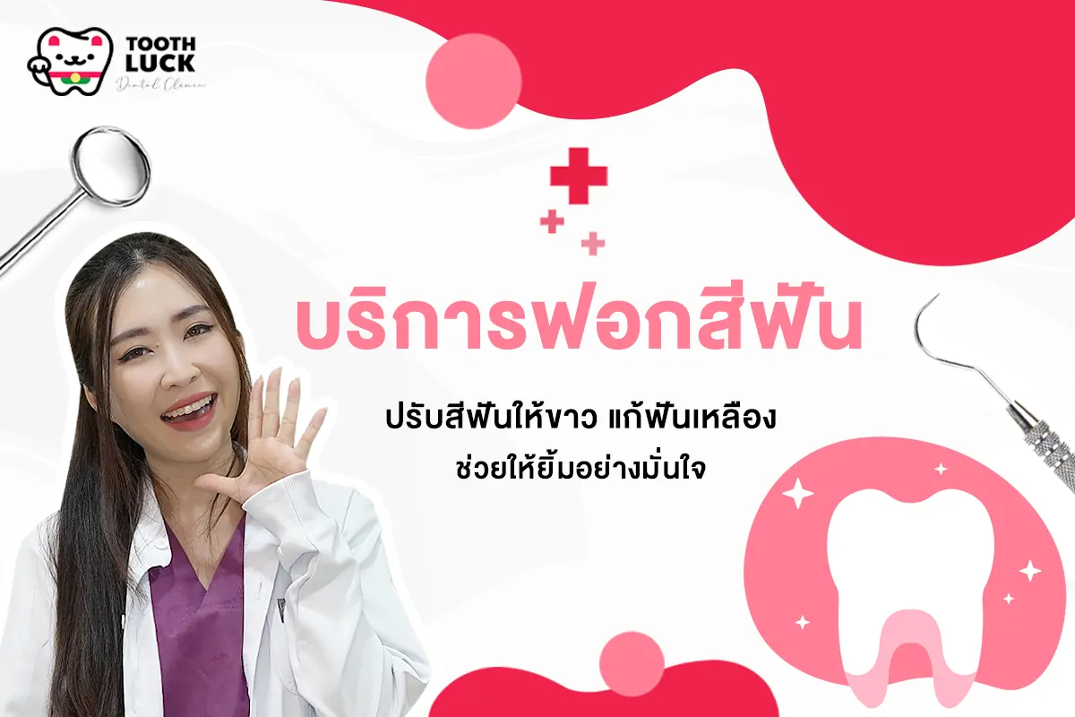 บริการฟอกสีฟัน ปรับสีฟันให้ขาว แก้ฟันเหลือง ช่วยให้ยิ้มอย่างมั่นใจ