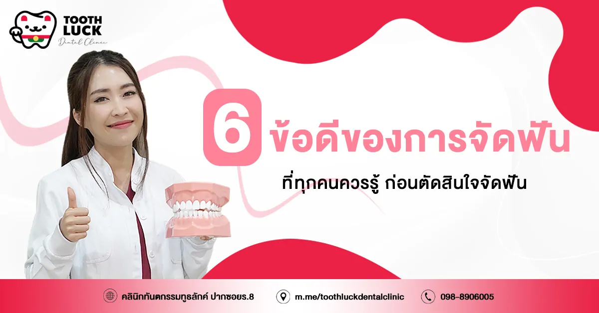 ข้อดีของการจัดฟัน