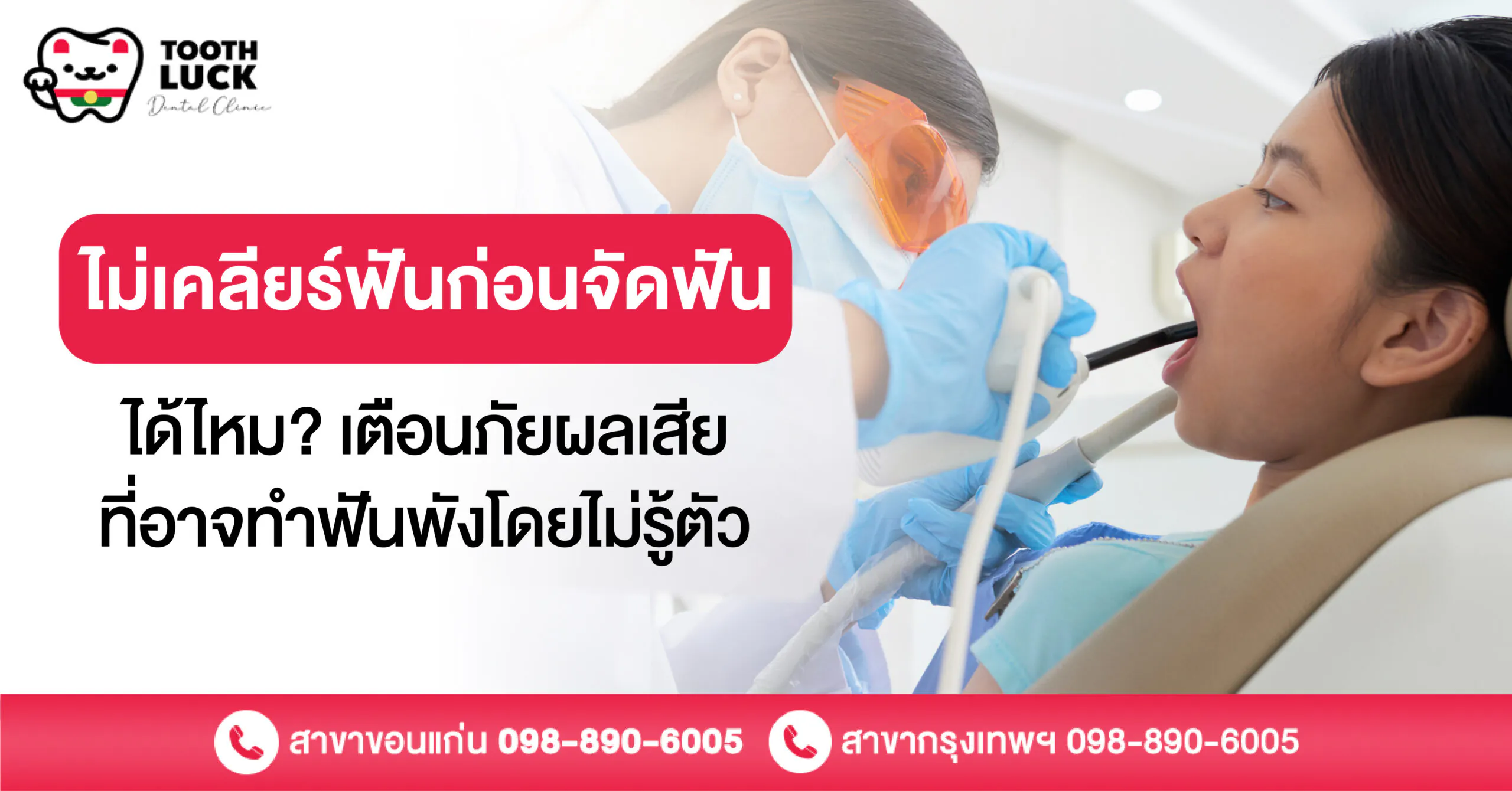ไม่เคลียร์ฟันก่อนจัดฟัน ได้ไหม? เตือนผลเสียที่อาจทำฟันพังโดยไม่รู้ตัว