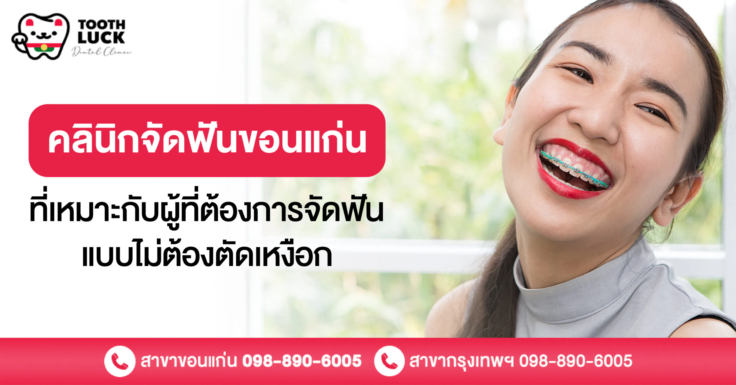 คลินิกจัดฟันขอนแก่นที่เหมาะกับผู้ที่ต้องการจัดฟันแบบไม่ต้องตัดเหงือก