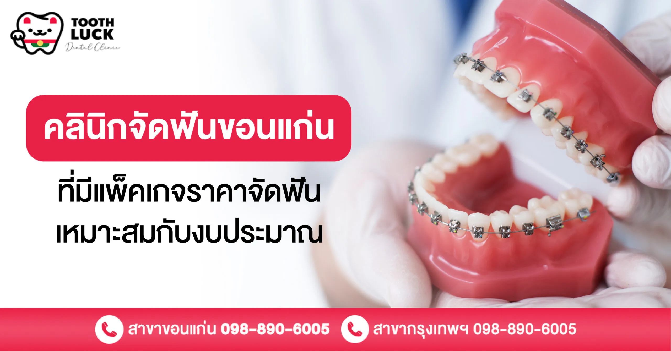 คลินิกจัดฟันขอนแก่นที่มีแพ็คเกจราคาจัดฟันเหมาะสมกับงบประมาณ