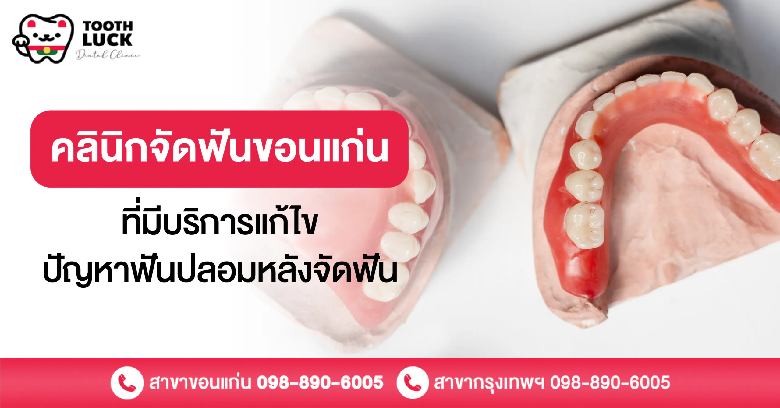 คลินิกจัดฟันขอนแก่นที่มีบริการแก้ไขปัญหาฟันปลอมหลังจัดฟัน