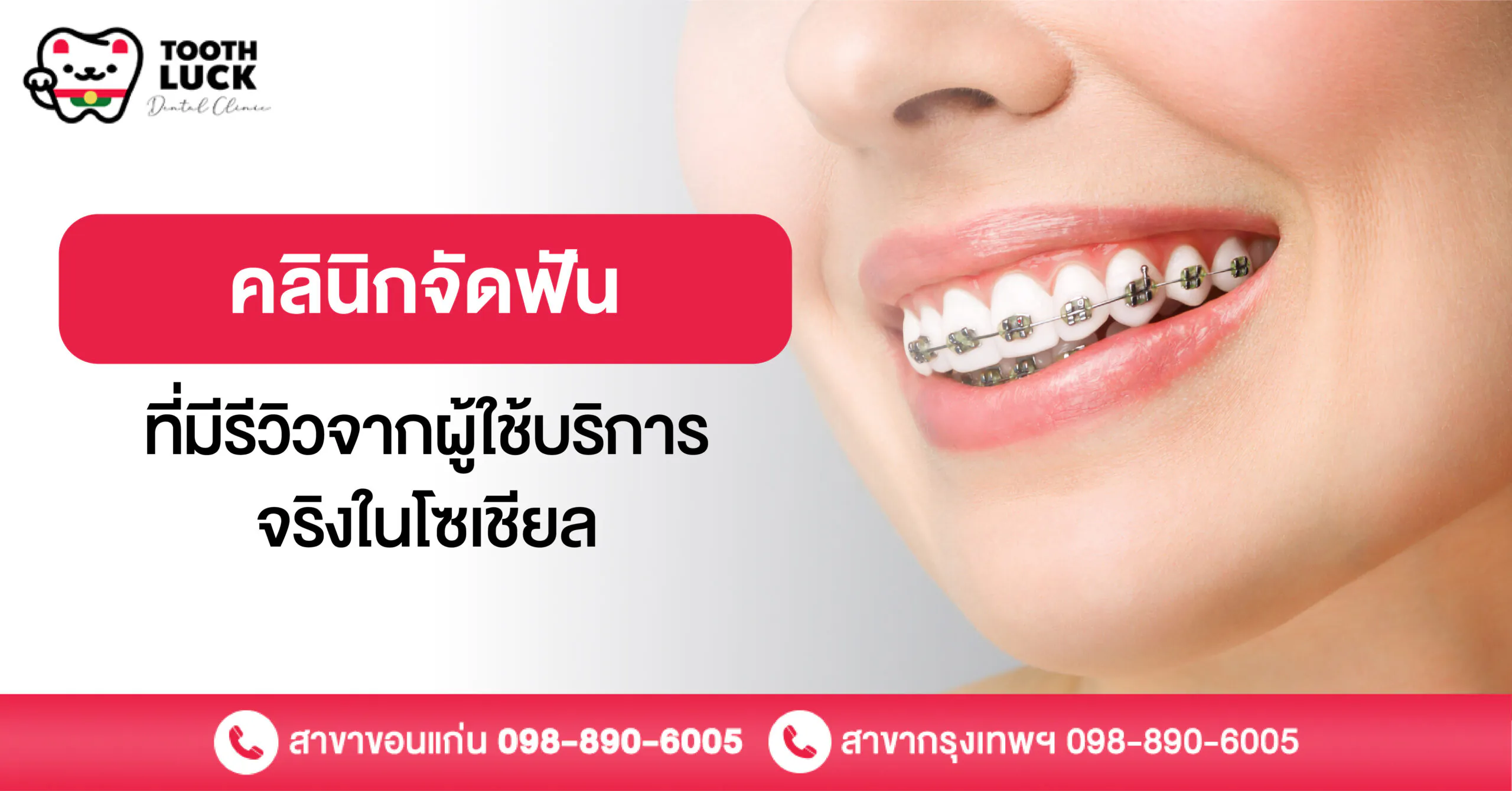 คลินิกจัดฟันที่มีรีวิวจากผู้ใช้บริการจริงในโซเชียล