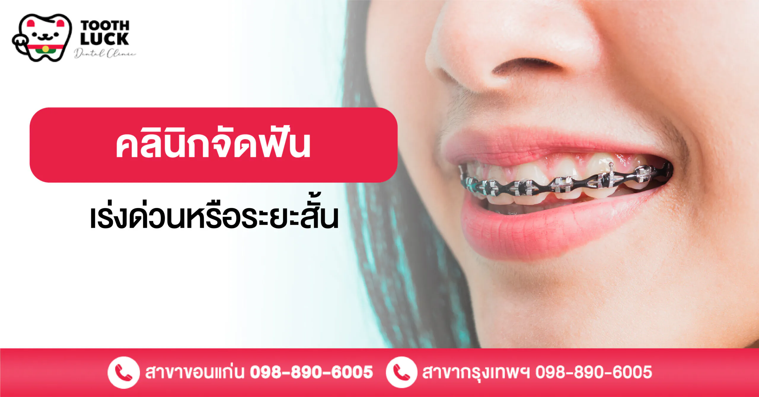 คลินิกจัดฟันเร่งด่วนหรือระยะสั้น
